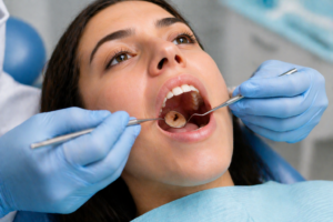 sauver sa dent d'une carie dentaire chez le chirurgien dentiste, comprendre les symptômes et les soins