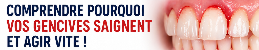 pourquoi vos gencives saignent